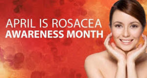 rosacea